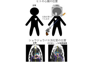 阪大、ハエの内蔵の左右非対称性に関与する「ドクター・ノオ遺伝子」を同定