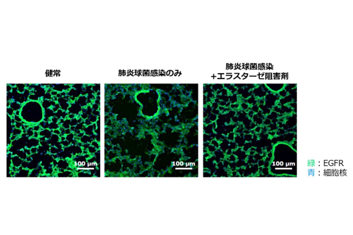 肺炎球菌に感染したマウスの肺組織におけるEGFRの発現