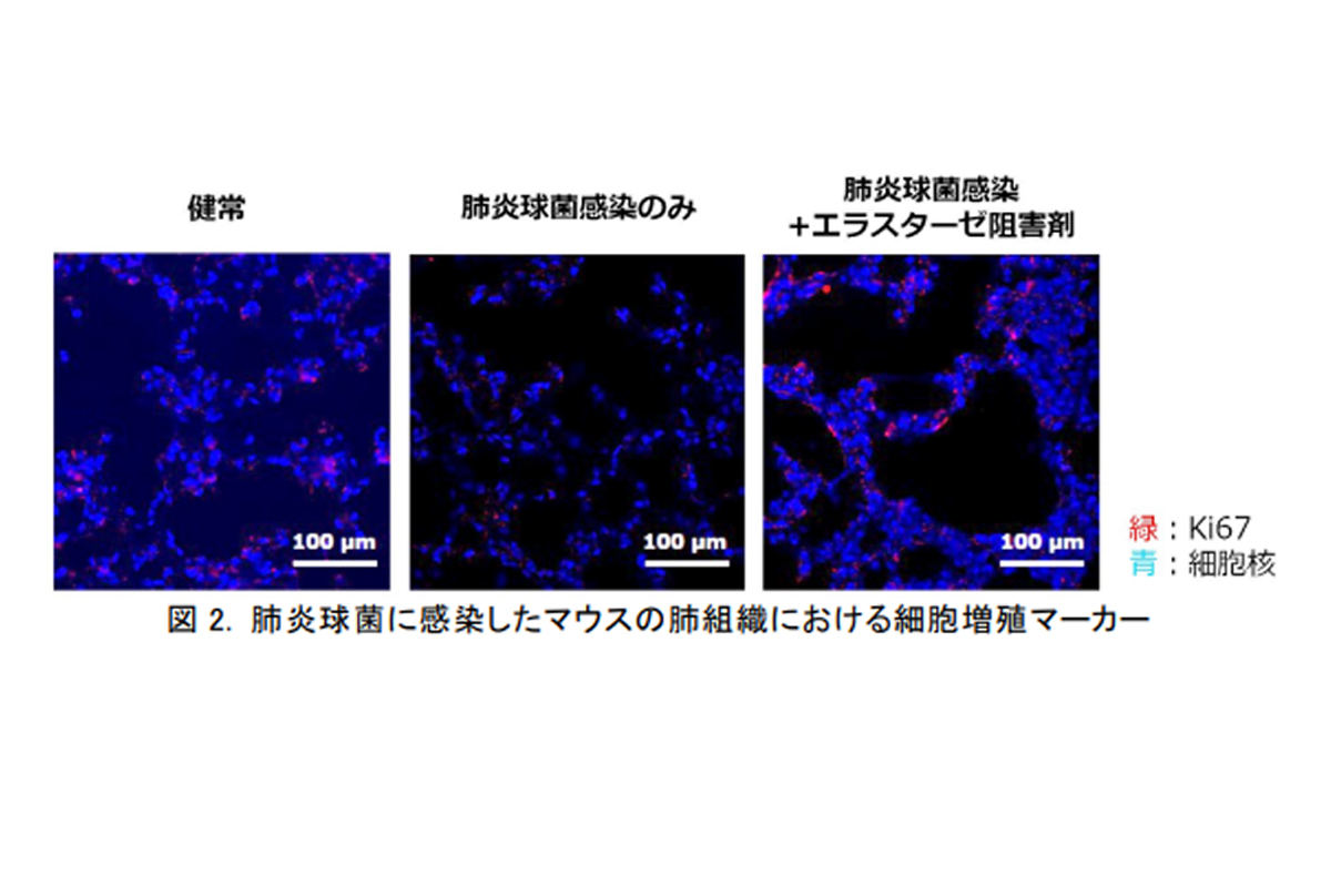 肺炎球菌に感染したマウスの肺組織における細胞増殖の比較