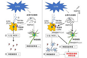 阪大、脳梗塞後の神経機能障害を回復させる新たなメカニズムを発見