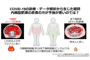 内臓脂肪の蓄積が新型コロナの重症化リスクを高める、東京医科歯科大が確認　