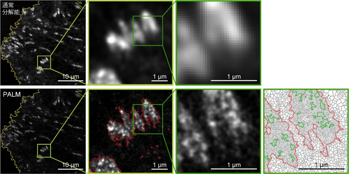 (上段)通常分解能の画像。(下段)超解像PALM画像。(左列)細胞膜を、ほぼ細胞全体にわたって撮影した画像(左)。(左から2列目・同3列目)接着斑の部分を、順次拡大している。見ている分子は、接着斑を構成するパキシリン。(下段・右端)すぐ左の画像が定量解析されたもの。緑が島の輪郭。赤が接着斑全体の輪郭。