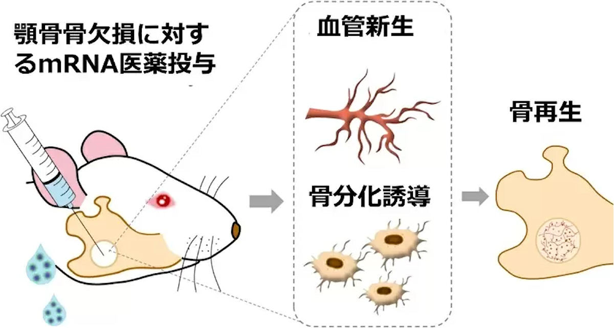 mRNA医薬を用いた骨再生治療。