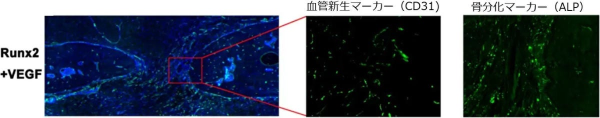 骨再生部位の免疫組織学的解析(Runx2 mRNA、VEGF mRNA組み合わせ投与)。