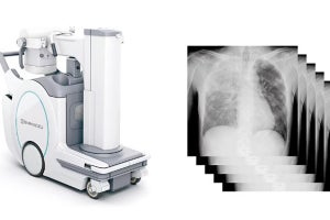 島津製作所、連続撮影機能を搭載した回診用X線撮影装置を発売