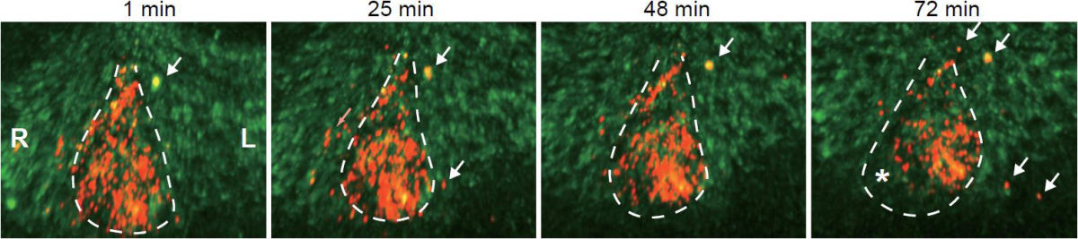 PKD1L1タンパク質のメッシュワークを介した左向き移送。