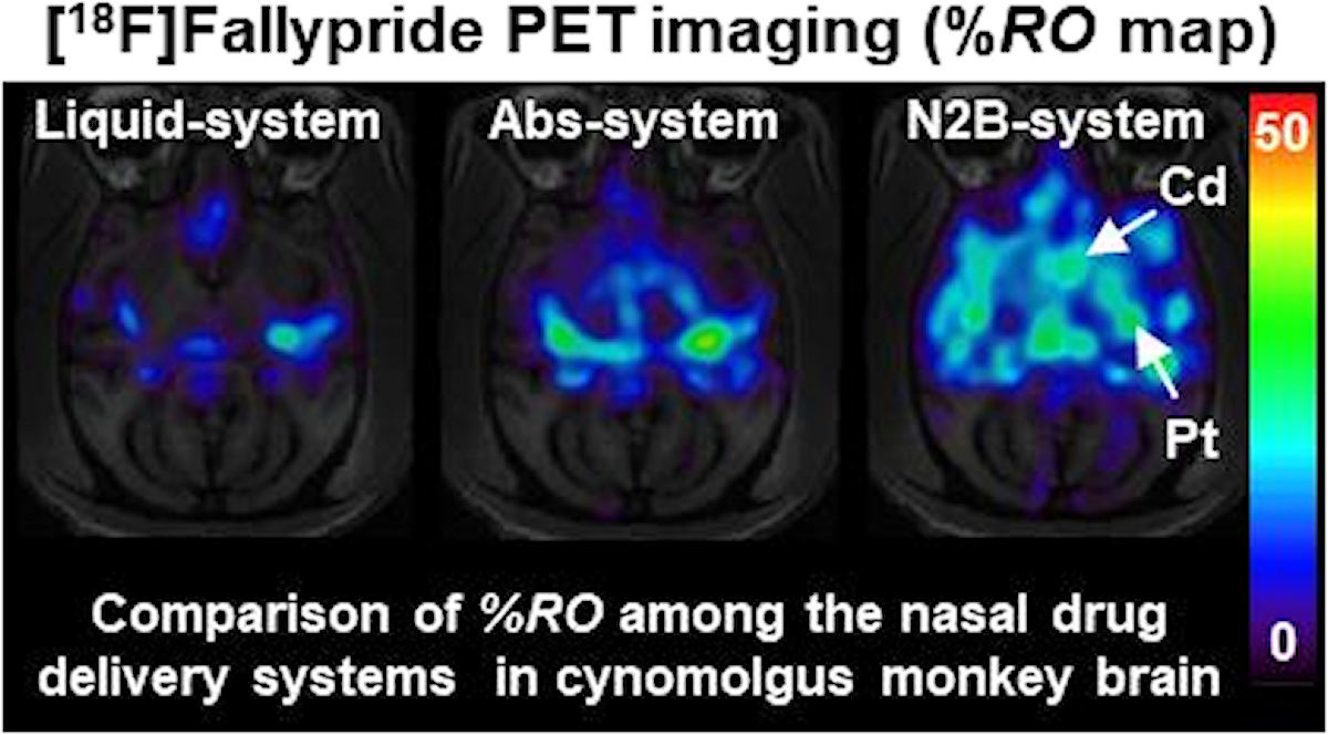 経鼻投与されたドンペリドンによるF18ファリプライド脳結合の低下率(ドンペリドンの脳移行性の指標、明るいほどドンペリドンが脳へ移行していることが示されている。Cd;尾状核、Pt;被核)。(左・中)従来の経鼻投与技術。(右)N2B-systemを用いて嗅部選択的にドンペリドンを投与することで、従来技術と比較して高いドンペリドンの脳移行が達成されることが、分子イメージング技術により生体を傷つけることなく示された。