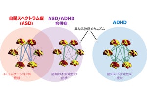 東大、ASD/ADHD合併症は単純な両者の合併症ではないことを発見
