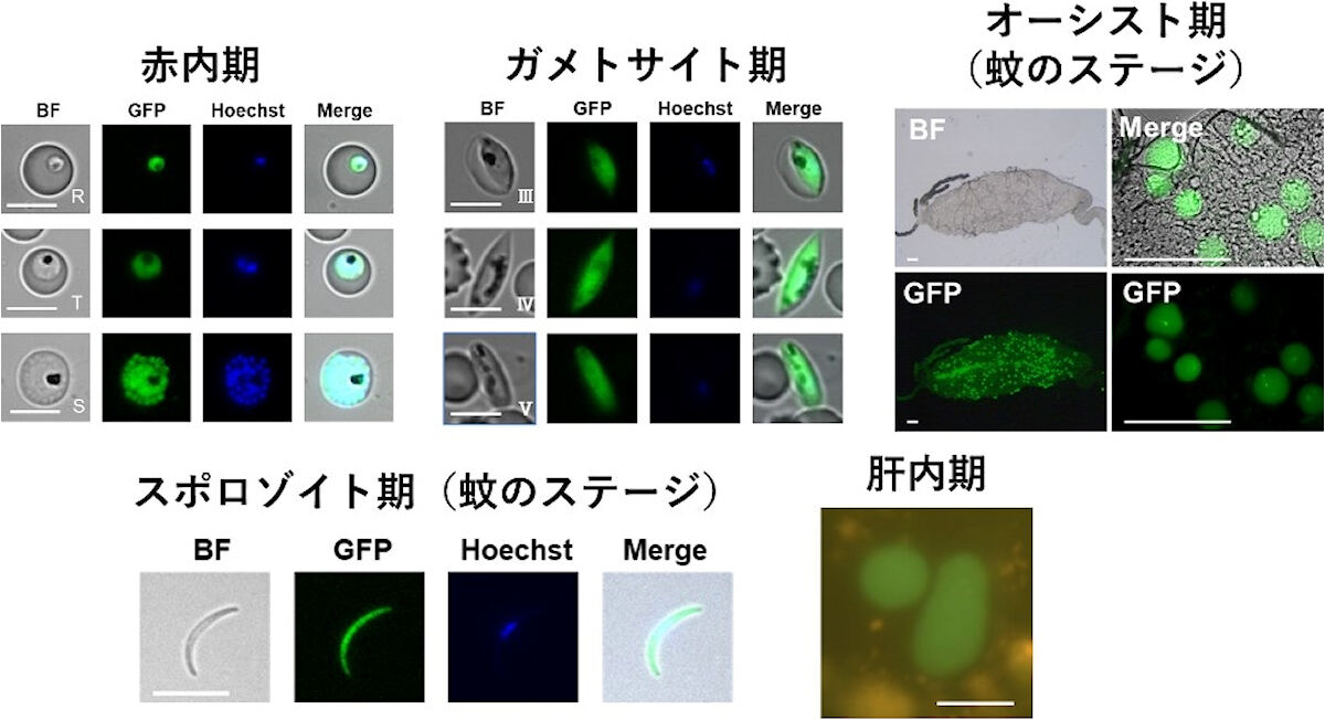 さまざまなステージの熱帯熱マラリア原虫におけるGFP発現。