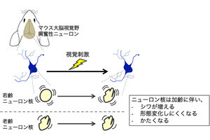 脳の老化の原因はニューロンの核が加齢で硬くなること？　東大が確認