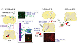 新大、ALSにおいて原因の異常タンパク質の神経回路での広まり方を確認