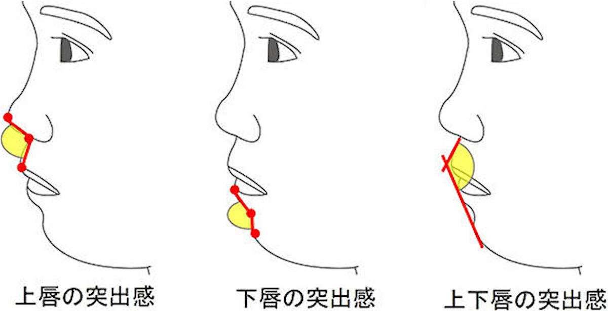 口元の形に関する解析部位。