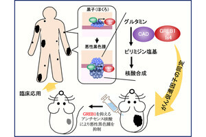 阪大、皮膚がん「悪性黒色腫」の治療のための新たな分子標的を発見