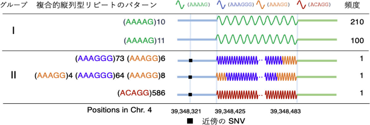 複合型縦列反復配列の例。脳疾患「CANVAS」の原因と考えられているリピート伸長が存在する遺伝子「RFC1」の第2イントロンに存在する複合型の縦列反復配列の例。