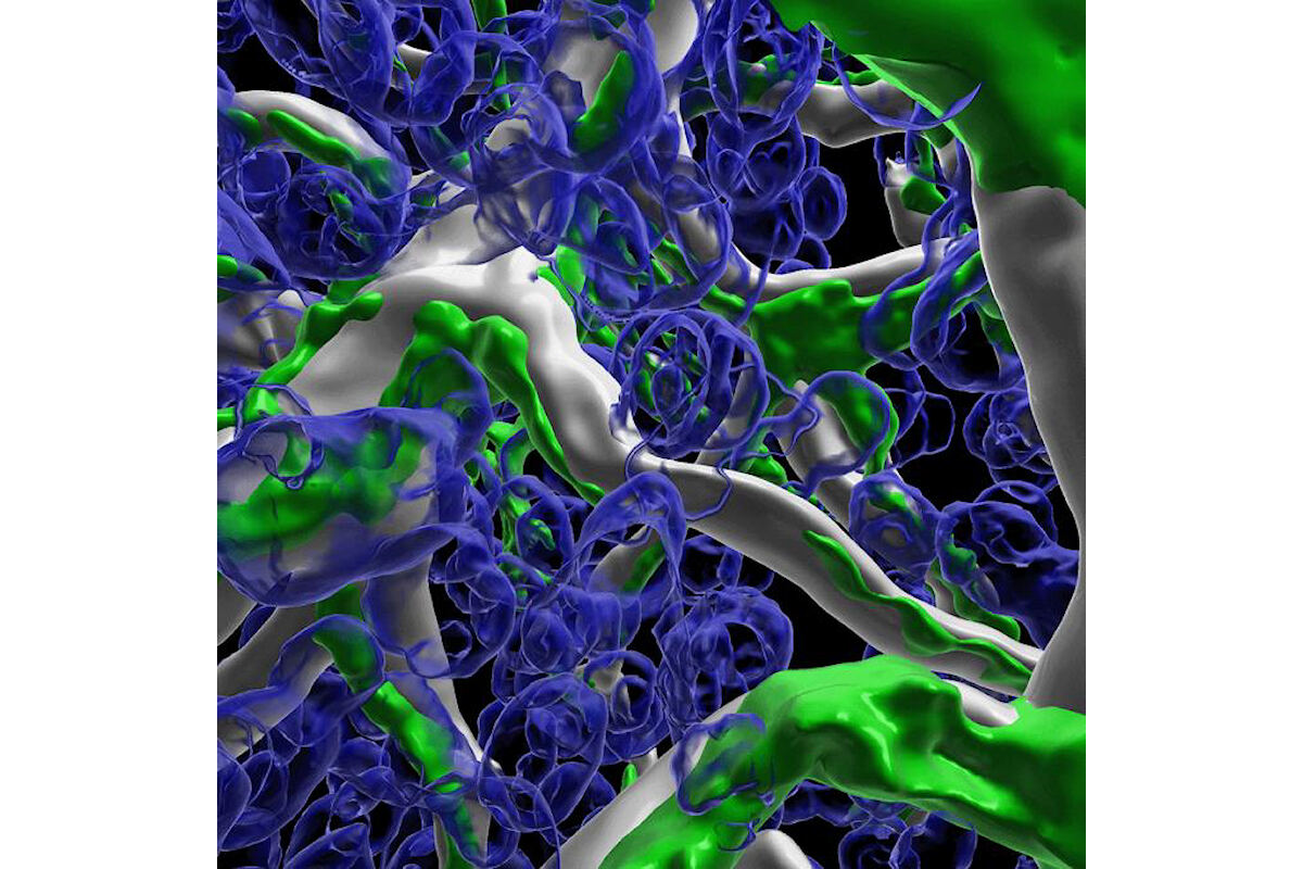 3Dで見た膵星細胞。緑が膵星細胞、白が毛細血管。その他の細胞(膵腺房の上皮細胞など)は、細胞核のみが青で示されている。