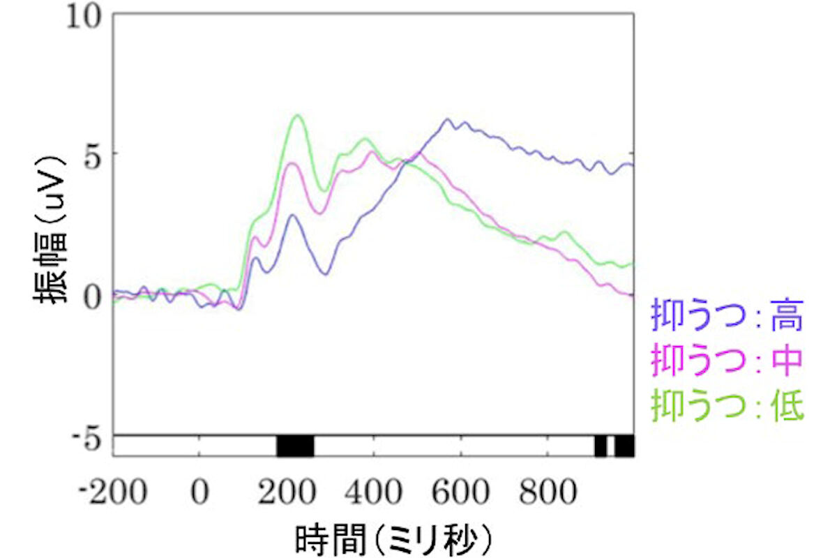 抑うつ症状と脳波反応の関