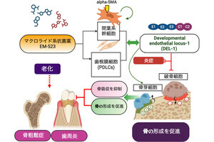 新大など、高齢者の骨の再生に有効な分子を動物モデル実験で発見