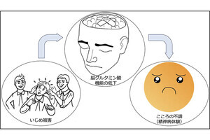 いじめが思春期の脳と心に不調を来す仕組みを東大などが脳科学的に確認