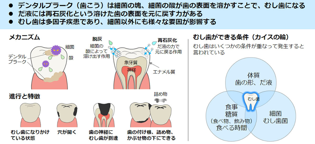 eラーニングのコンテンツ例