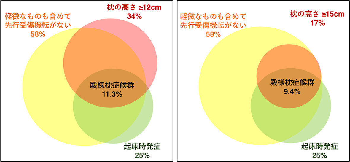 (1)高い枕の使用、(2)起床時発症、(3)先行受傷機転がない、の3条件を満たす特発性椎骨動脈乖離患者の場合