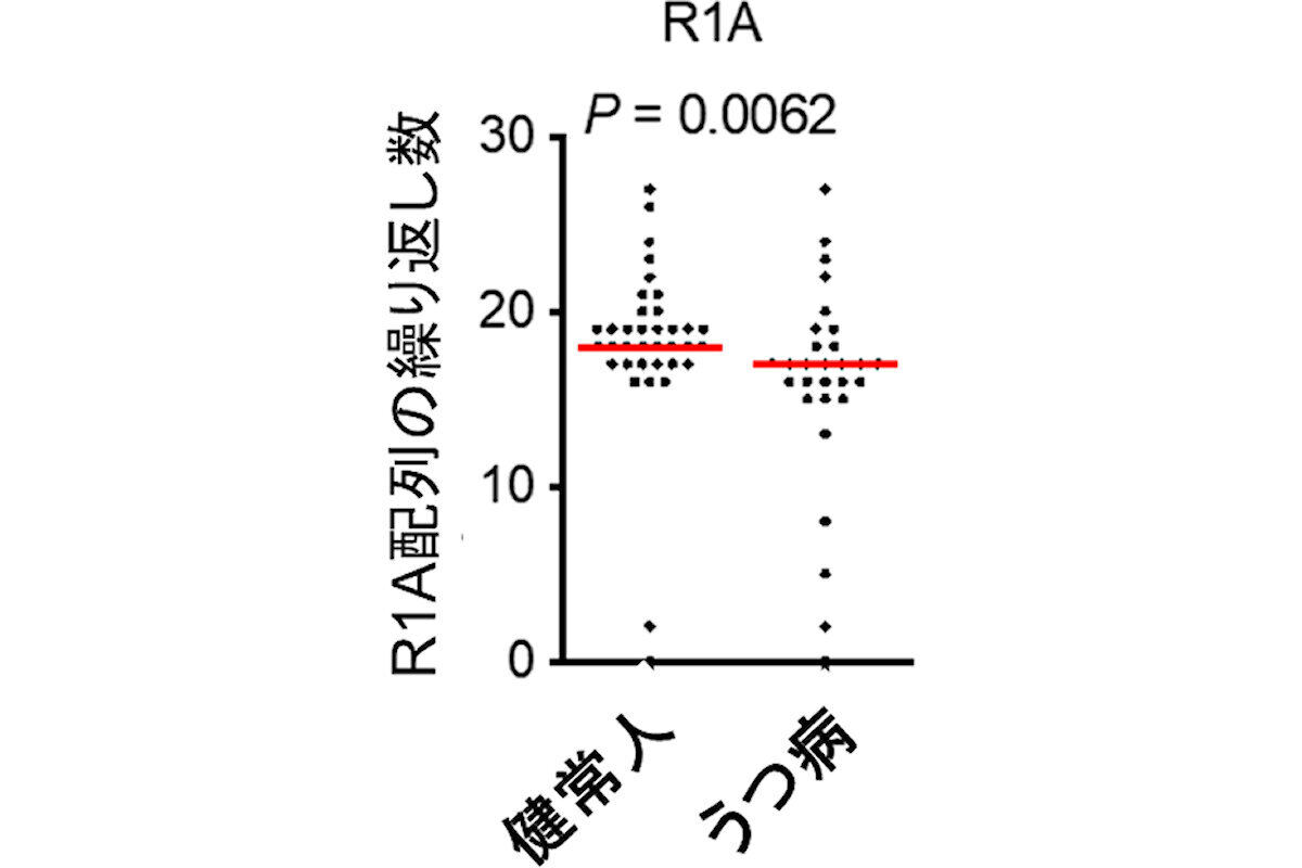 R1A配列の数とうつ病との関係