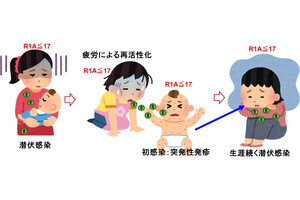 うつ病になりやすい体質が遺伝する仕組み、慈恵医大が解明