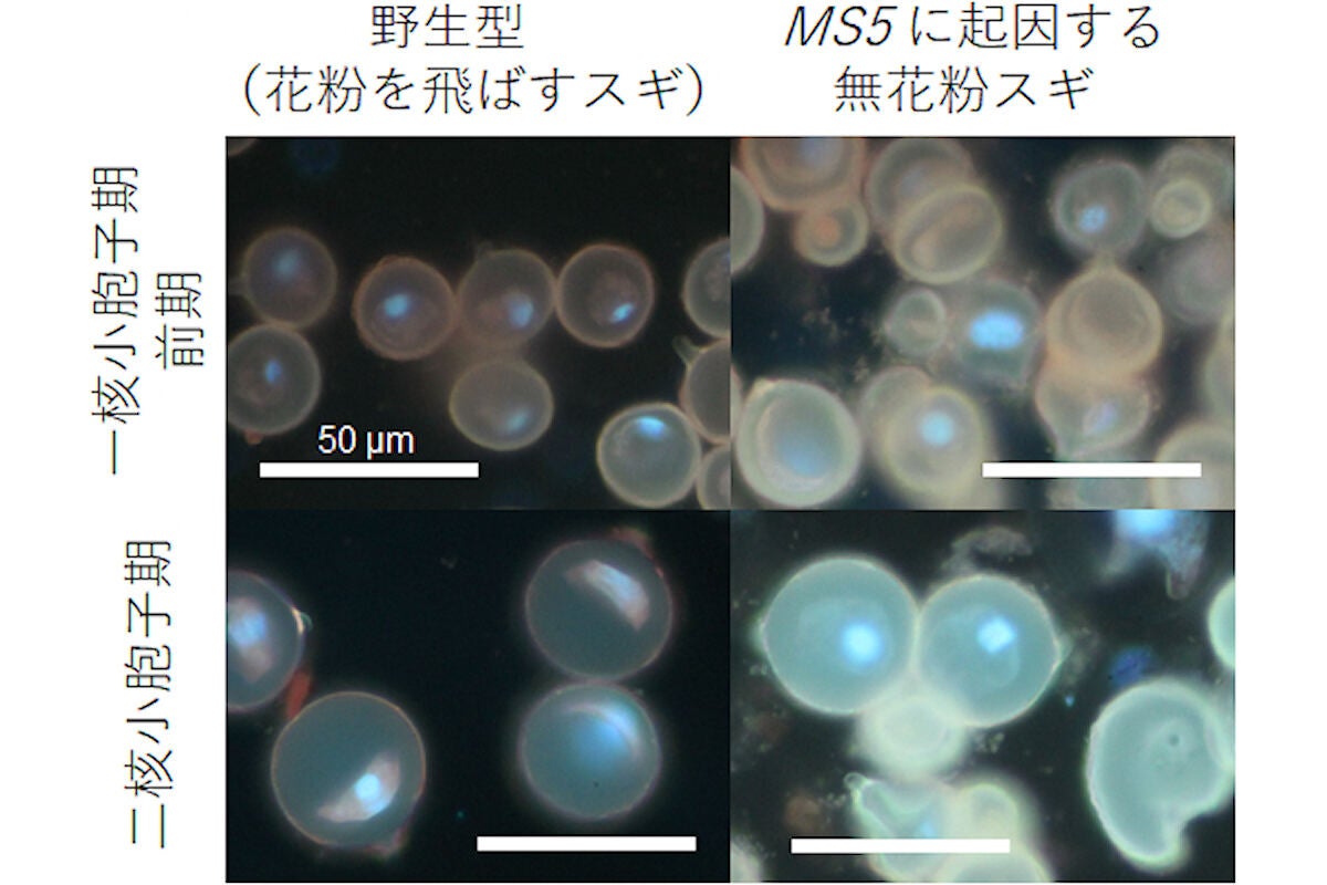 野生型とMS5に起因する無花粉スギの一核小胞子期前期および二核小胞子期の蛍光顕微鏡画像