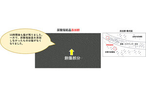 明治、尿酸値の高さが血管の炎症を引き起こす可能性があることを確認