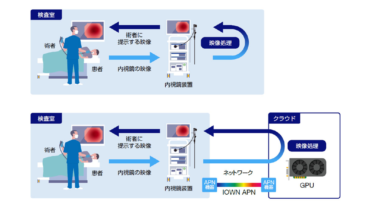 クラウド内視鏡による手術のイメージ