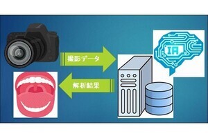 電通総研×東大医学部附属病院、AI活用で口腔癌の画像診断支援システムを共同開発