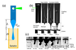 無針注射器の実現へ - 農工大がマイクロジェットの貫通深度の関連要因を特定