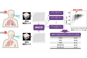 NIMSと筑波大、呼気から肺がんを診断する技術の開発に向けて大きな進展