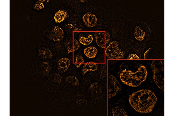 細胞の内部を鮮明に観察できる蛍光顕微鏡技術を開発 阪大など