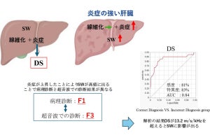 広島大、肝臓病を超音波を用いて正確に診断する新たな検査方法を発見　