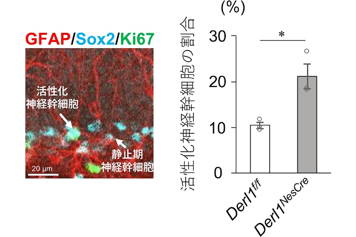 Derlin-1遺伝子欠損による活性化神経幹細胞の増加