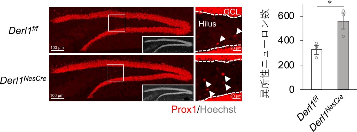 Derlin-1遺伝子欠損による異所性ニューロンの増加
