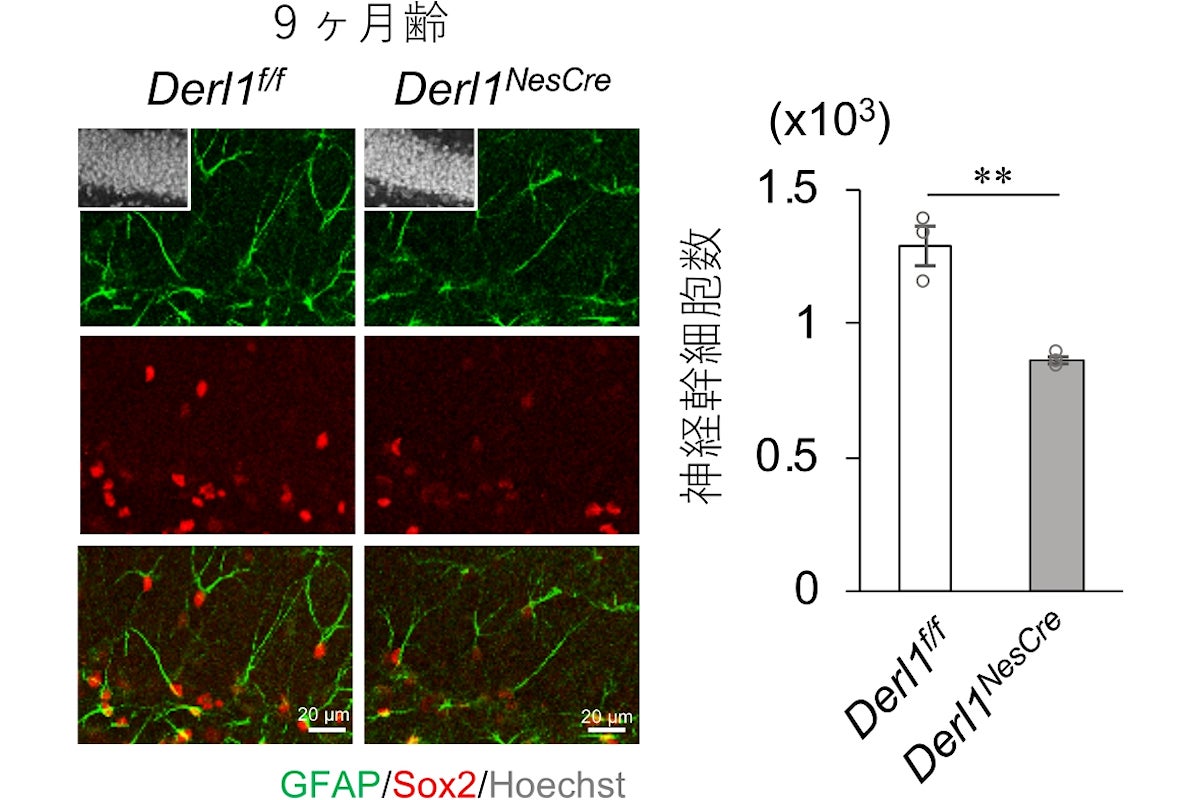 Derlin-1 遺伝子欠損による神経幹細胞の枯渇