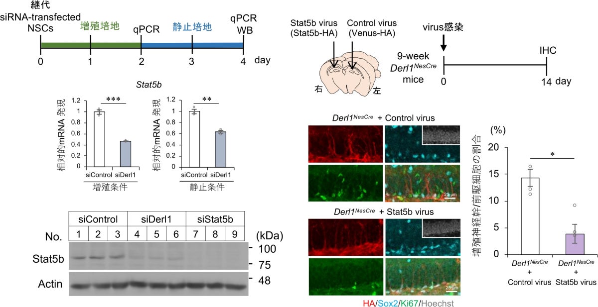 Derlin-1欠損によるStat5bの発現低下と、Stat5b外来発現による神経幹細胞の異常増殖の改善