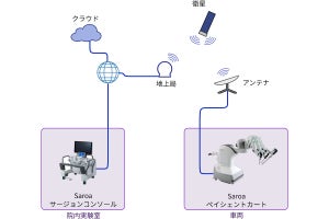 阪大など、スターリンク衛星を利用した遠隔ロボット手術の実証実験に成功