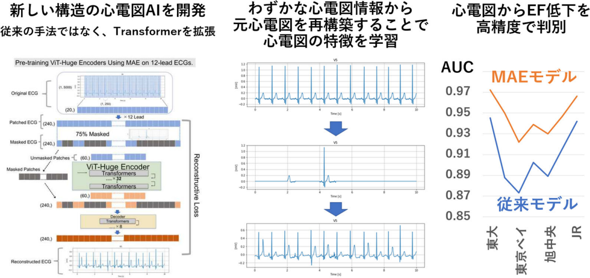 今回開発されたMAEを用いたAI心電図解析技術。従来手法を超える精度が実現された