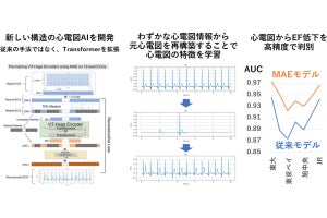 東大、データ収集のコストや時間を削減可能な心電図解析用AIを開発