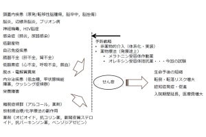 順天堂大、高齢化社会に伴い増加中の「せん妄」を予防する薬剤を発見