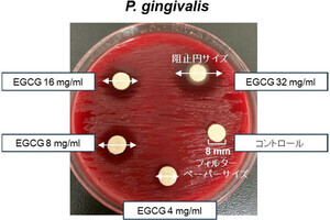 東北大、緑茶中のカテキンが主要な歯周病関連細菌を死滅させることを確認