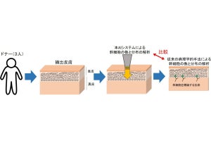 日本メナード化粧品など、非侵襲的に皮膚の幹細胞の加齢変化の把握に成功