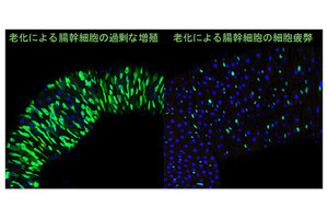 理研、老化すると組織幹細胞も疲弊することをハエから発見