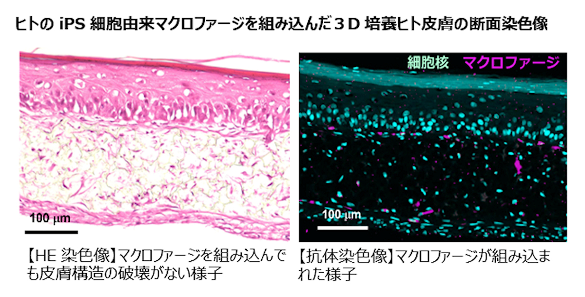 ヒトiPS細胞由来マクロファージを組み込んだ3D培養ヒト皮膚の断面染色像