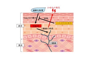 皮脂の酸化が頭皮のかゆみを引き起こすメカニズム、第一三共ヘルスケアが解明