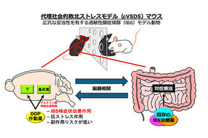 脳に作用する過敏性腸症候群の治療薬開発に光、東京理科大学がマウス実験