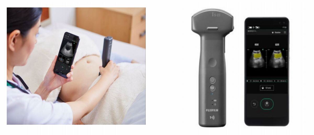 排泄エコー「iViz air」
