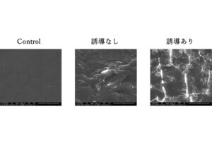 慶応大、難分解性のポリプロピレンを分解する微生物を鎌倉で発見